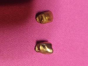 lot 7B image: Teeth with gold and silver crowns